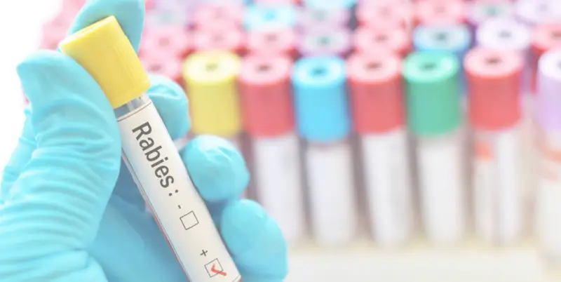 Comprehensive Guide to the Rabies Titer Test for Pet Relocation